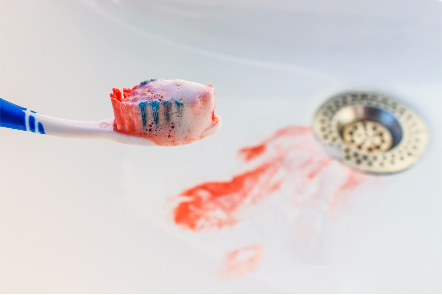 Toothbrush with blood on the bristles over a sink with blood from gum disease