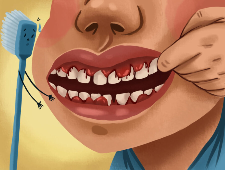 Graphic illustration of a person with bleeding gums, or periodontal disease.