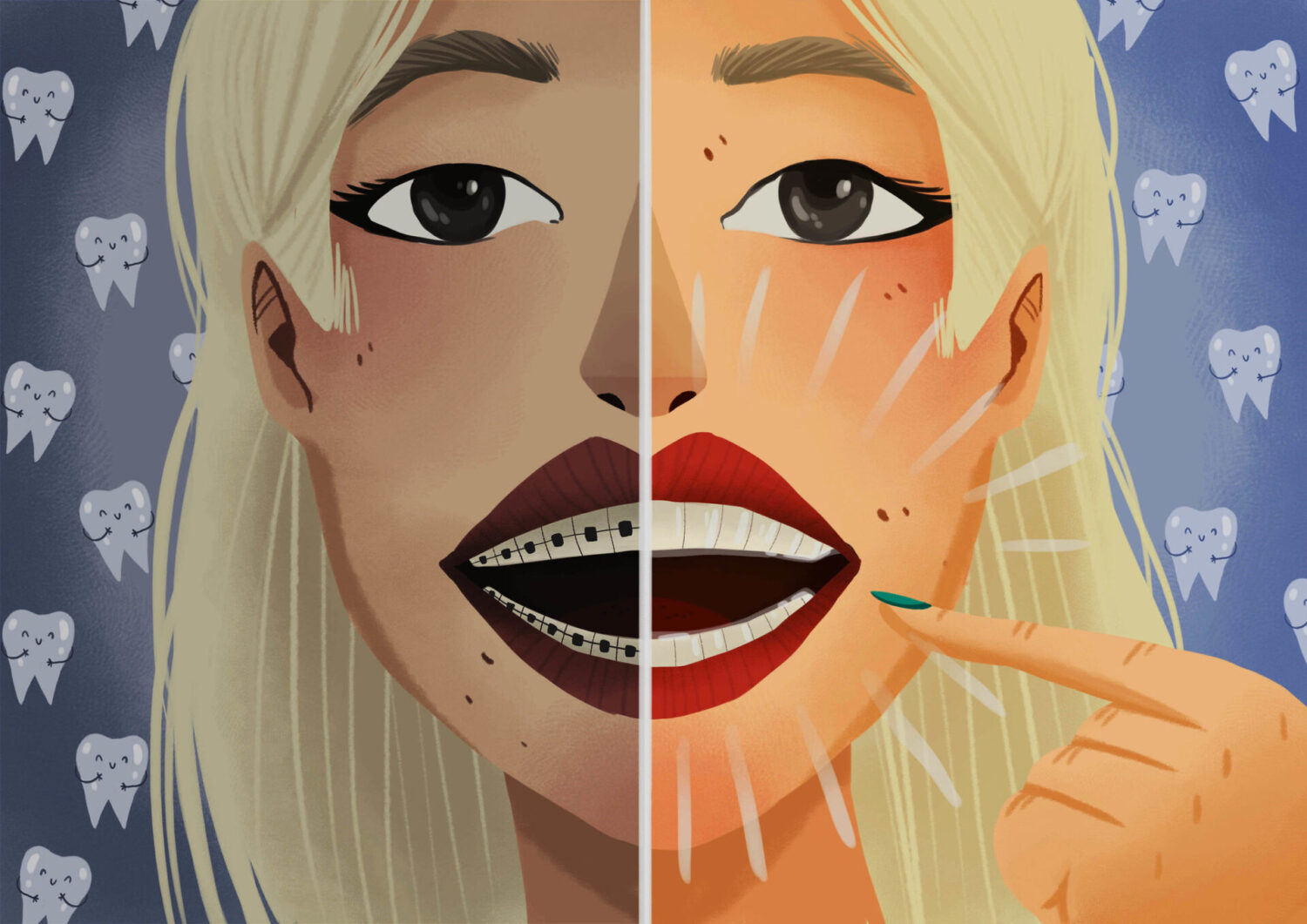 graphic illustration of clear aligner therapy vs traditional braces, common questions, clear aligners in Hot Springs Village